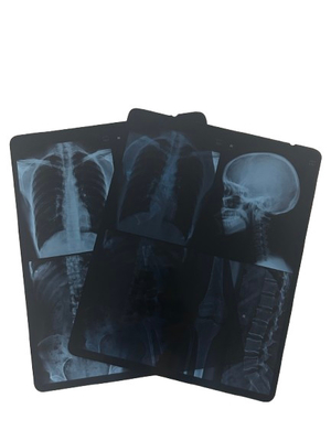 Inkjet Blue Pet Film Waterdicht 8*10 10*12 10*14 Inch PET Xray Blue Sheet Medische Film Voor Digitaal Drukken