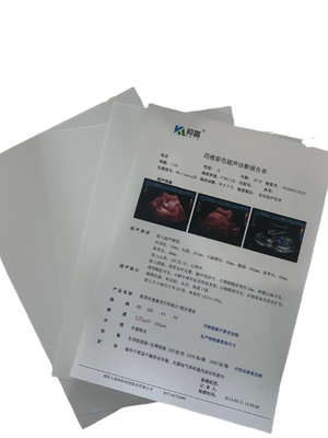 Min Dichtheid 0,28D röntgenfilm voor nauwkeurige en gedetailleerde diagnostische resultaten