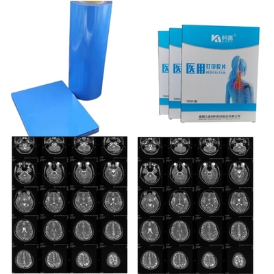 Medische afbeelding Droge PET Inkjet Laser Medische Röntgenfilm 14x17 inch