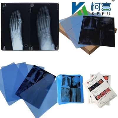 14*17 inch medische röntgen/CT/DR droge scanfilm voor röntgenlaserprinter en thermische beeldprinterapparatuur