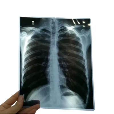 14*17 inch medische röntgen/CT/DR droge scanfilm voor röntgenlaserprinter en thermische beeldprinterapparatuur