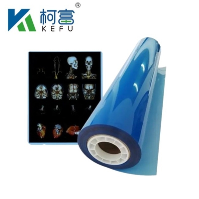 Gepersonaliseerde grootte Blauw-wit Inkjet Medische Röntgenfilm Voor Inkjet Printers In Platen