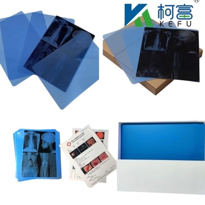 Gepersonaliseerde grootte Blauw-wit Inkjet Medische Röntgenfilm Voor Inkjet Printers In Platen