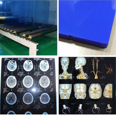 Waterdichte medische thermische X-ray film X-ray blauwe film voor inkjetprinters