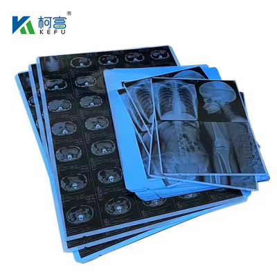 Blauwe PET-gebaseerde X-ray thermische / inkjetfilm medische afbeeldingen voor klinieken en ziekenhuizen