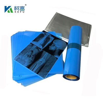 175mic 215mic High Definition Medical Imaging CT DR Inkjet Blue Film Medische röntgenfilm voor huisdieren A3 A4 Transparante blauwe drukfilm