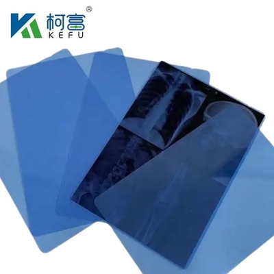 Blauwe PET-gebaseerde X-ray thermische / inkjetfilm medische afbeeldingen voor klinieken en ziekenhuizen