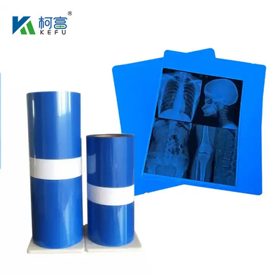 Inktstraalprinten X-Ray Medische droge Inkjet X-Ray Imaging Film voor medische apparaten Fabriek directe verkoop