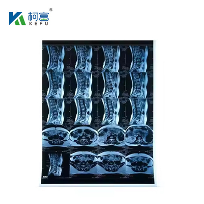 Inkjet Medische X-ray Blauwe Film 210micron CT DR Film A4 8x10 Plaat of rol Voor Medische Inkjet Printmedia