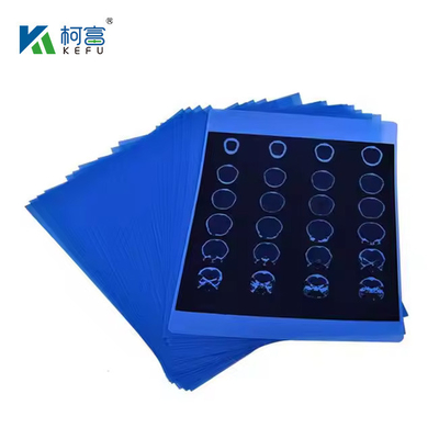 Inkjet Medische X-ray Blauwe Film 210micron CT DR Film A4 8x10 Plaat of rol Voor Medische Inkjet Printmedia