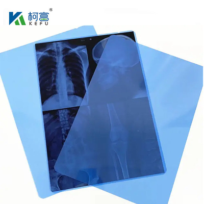 Easy - To - Handle And Flexible Medical Laser Film, 13x17in, 0.15mm, met een gladde en buigsame oppervlakte