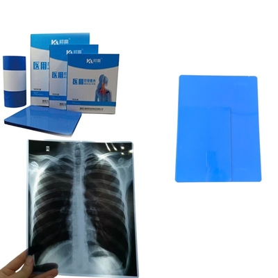 A4-formaat bladen blauwe inkjet X-ray film voor medische afbeelding X-ray CT CR DR MTR PET
