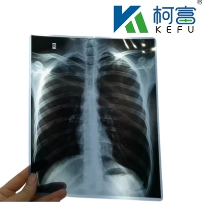 Gratis Proefproef Inkjet X-Ray Paper Film Imaging Drukt door Printer Voor Radiologie Medische Diagnose 8*10 Printer