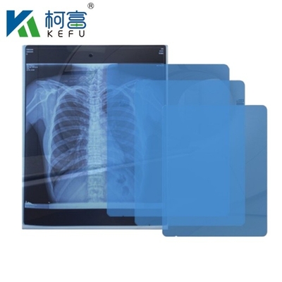 8x10 10x12 10x14 14x17 inch medische droge DIHL-film Laser-röntgenfilm voor klinieken en ziekenhuizen