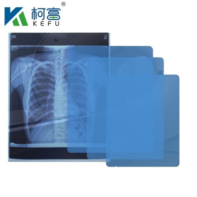 Blauwe Inkjetfilm X-Ray Printing 8'*10' PET Inkjet Blauwe Film Medische Droge Röntgenfilm