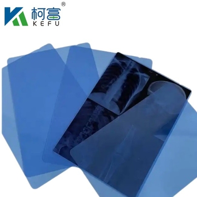 X-ray thermische medische film 8*10 14*17 Blauwe kleur medische droge beeldvormende film met printer