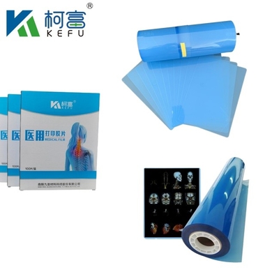 Laserfilm met hoog contrast, medische inkjetfilm, blauwe PET-röntgenfilm voor inkjet- en laserprinters