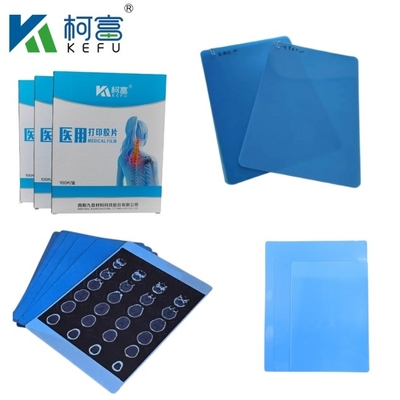Medische laserfilm met geavanceerde anti-nevel en anti-glans functies 11x13in 0.12mm