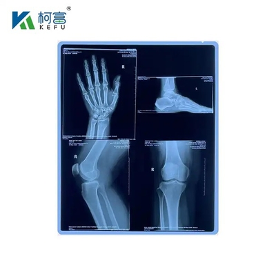 Precieze gecoate en micro-gestructureerde medische laserfilm 13x18in 0.14mm voor consistente beeldresultaten