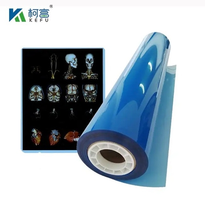 High Definition en Wide Gamut Medical Laser Film 17x22in 0.17mm voor gedetailleerde en levendige medische onderzoeken