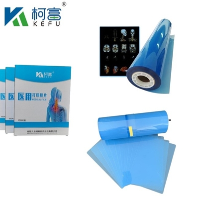 Laserfilm met hoog contrast, medische inkjetfilm, blauwe PET-röntgenfilm voor inkjet- en laserprinters