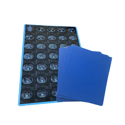 Hoogwaardige 125 micron halfdoorzichtige witte laser medische X-ray PET-plastic films voor medische toepassingen