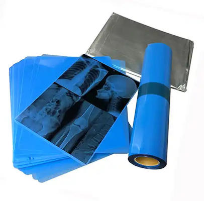 Inleiding van 125 micron half - transparante witte laser medische X-ray PET-plastic films voor medische doeleinden
