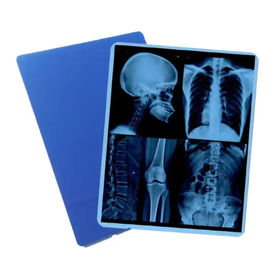 Inleiding van 125 micron half - transparante witte laser medische X-ray PET-plastic films voor medische doeleinden