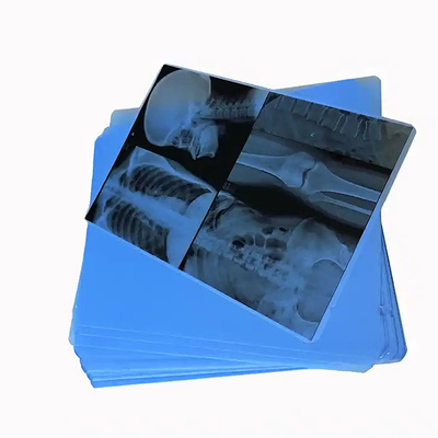 Ontdek 125 micron semi-transparante witte laser medische X-ray PET plastic films voor medische toepassingen