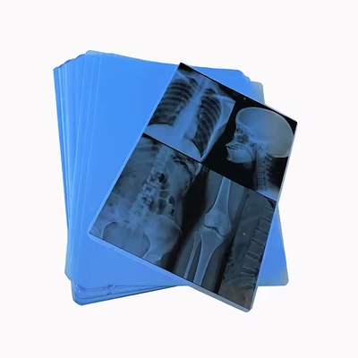 Onze professioneel geproduceerde medische blauwe röntgenfilm voor laserprinten is de keuze.