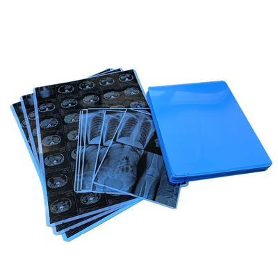 Onze professioneel geproduceerde medische blauwe röntgenfilm voor laserprinten is de keuze.