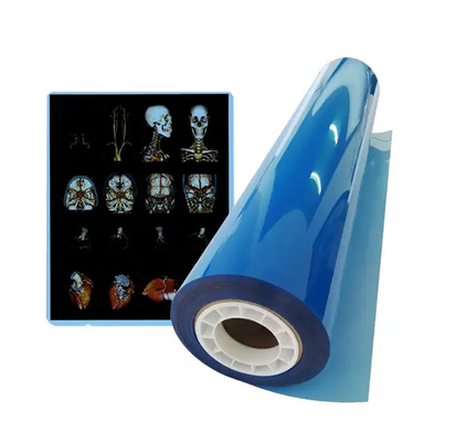 11*14 grootte Medische blauwe röntgenfilm voor laserprinten