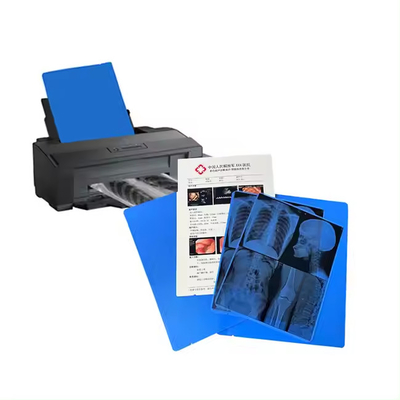Medische blauwe röntgenfilm voor laserprinten heeft een goede reputatie