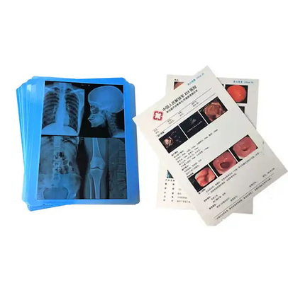 Medische blauwe röntgenfilm voor het laserprinten van medische hospital consumables