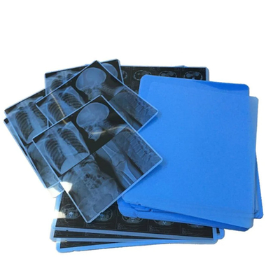 Speciaal geproduceerde medische blauwe röntgenfilm voor laserprinten