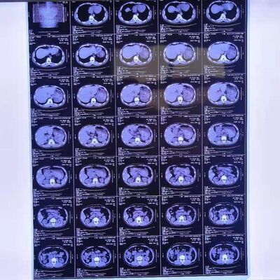 Medische röntgenfilms tegen redelijke kosten met hoge beeldstabiliteit die heldere en precieze medische diagnostische beelden leveren