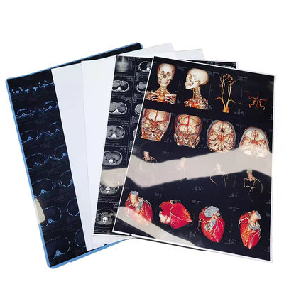 Hoge resolutie blauwwitte medische röntgenfilms met glanzende oppervlakte