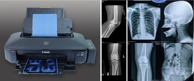 Fuji-printer droog beeldscherm inkjetfilm met een maximale transmissiedichtheid van ≥ 3,0 D 3