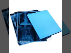 14*17 duim 35x43cm van de Filminkjet van Fuji Medische Droge de Transparantiefilm voor het Schermdruk